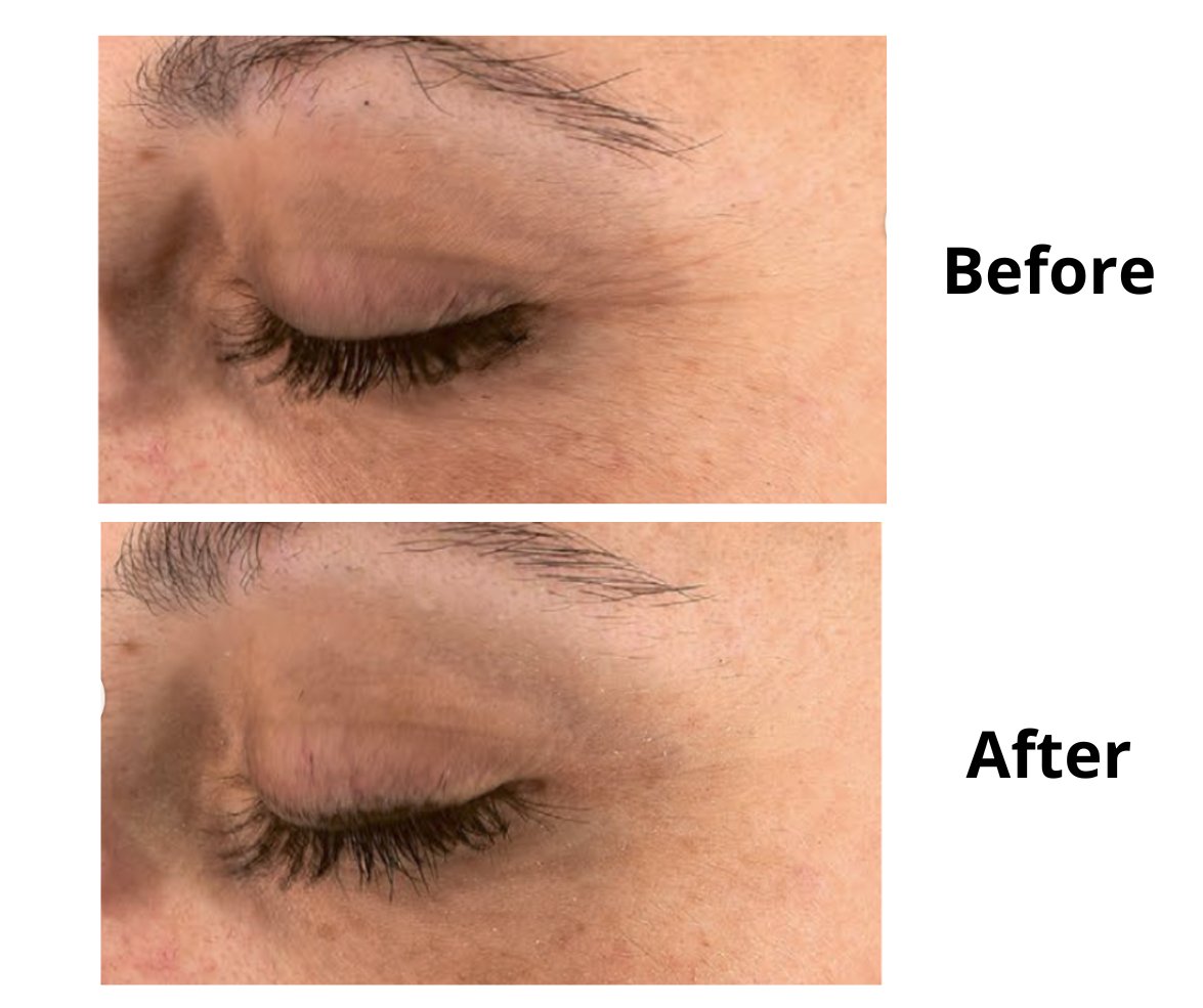 Apple Stem Cells Serum - Luisa True Skincare