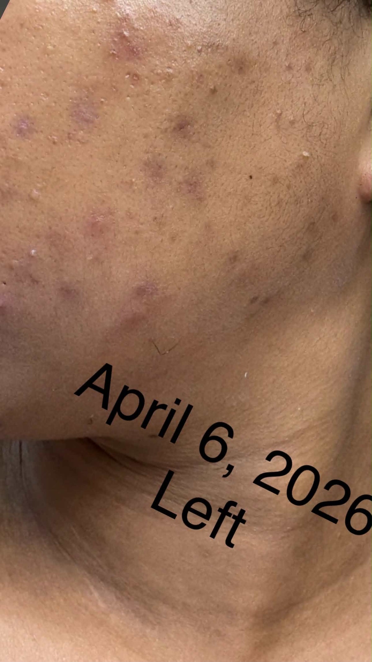 1:1 Skincare Consultation