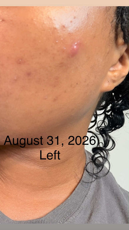 1:1 Skincare Consultation